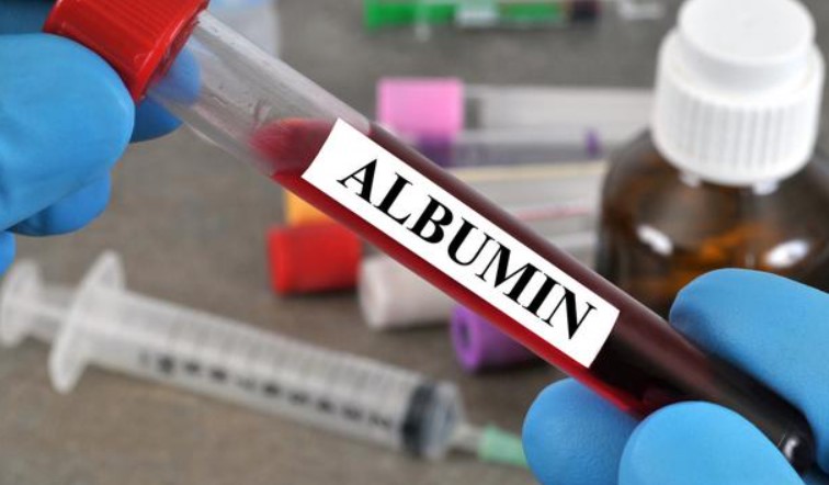 Mengenal Apa Itu Albumin dan Perannya untuk Daya Tahan Tubuh